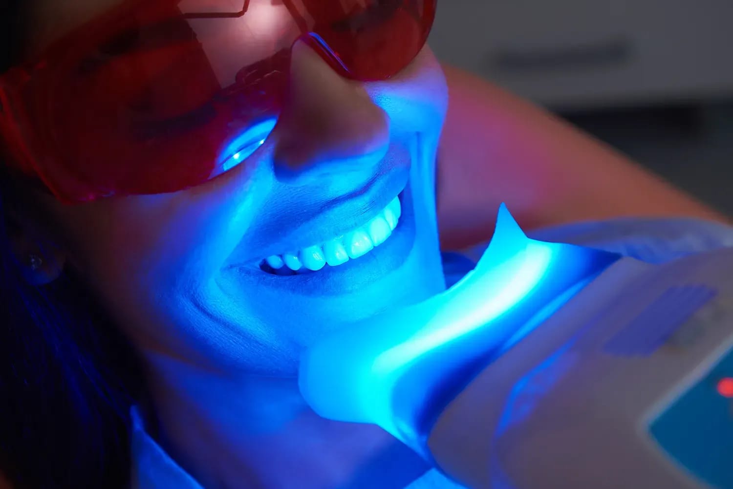 Professional blue light teeth whitening procedure